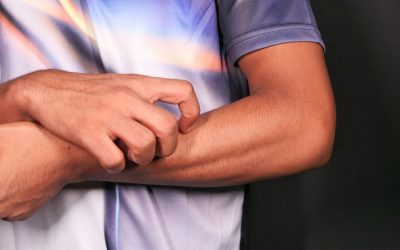 Persistent itching and liver health concerns